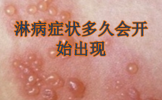  广东流行的传染病(广东最近爆发的传染病)