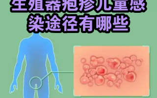  最近出来什么病毒感染(病毒感染一般几天能好)