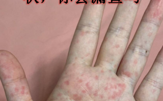  新型冠状病毒几年前就有了症状吗(新冠病毒去年就有了)