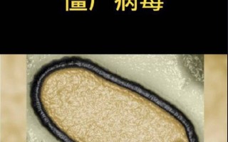  疫情病毒是什么样的病毒(疫情病毒到底是什么引起的)