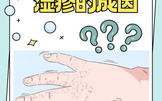  传染性湿疹怎么引起的(传染性湿疹怎么引起的原因)