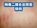  疫情的症状和表现图片卡通画(疫情症状描述)