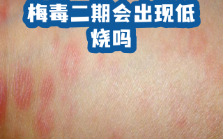  疫情的症状和表现图片卡通画(疫情症状描述)