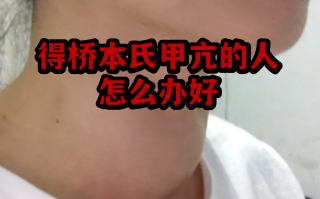  疫情的症状是什么样的(疫情的定义是什么)