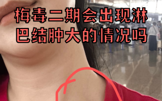  如果的疫情身体会发生什么(如果得疫情身体会发生什么)