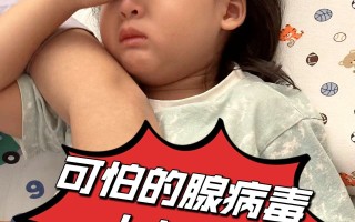  今年的病毒是什么症状啊视频(最新病毒症状是什么)