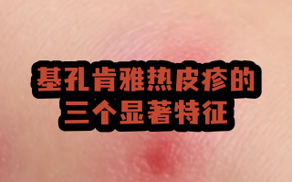  蚊虫病毒感染是什么症状有脸红发热(蚊虫感染皮肤用什么药)