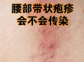  春季病毒感染的症状是什么(春季病毒感冒吃什么药)