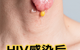  现在病毒最严重的地区是哪里(现在病毒在哪些城市)