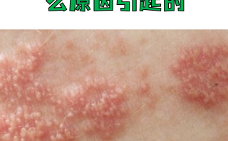  最近小孩流行的病毒叫什么(最近小孩流行的病毒叫什么名字)
