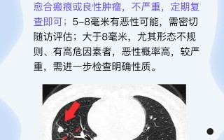  疫情会严重嘛现在(疫情会严重起来吗)
