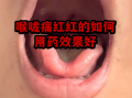  病毒引起的喉咙痛吃什么药管用呢(病毒引起的喉咙疼吃什么药)