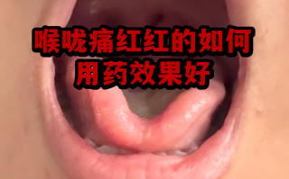  病毒引起的喉咙痛吃什么药管用呢(病毒引起的喉咙疼吃什么药)
