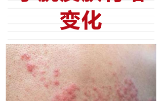 最近病毒的症状是什么样的(最近病毒的症状是什么样的表现)