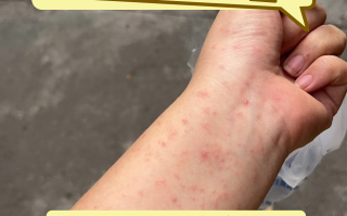  新冠疫情是哪一年出现的病毒感染症状(病毒感染过程)