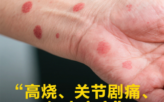  得了疫情有什么症状?(疫情得病有什么症状)