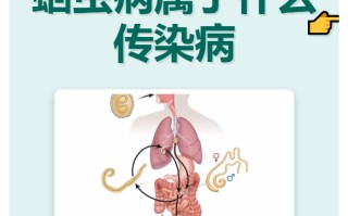  什么病是传染病(什么病是传染病但不是疫病)