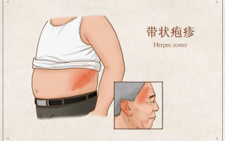  疫情病毒后遗症有哪些表现(疫情是什么意思)