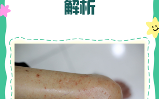  最近感染病毒的症状有哪些图片(最近感染病毒的症状有哪些图片大全)