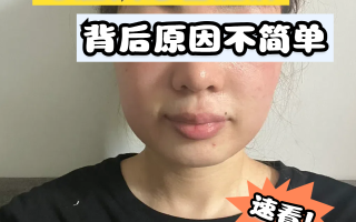  疫情后心理疾病有哪些症状表现(疫情过后心理)