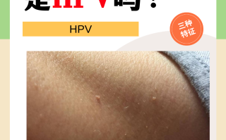  这些年出现的病毒是什么类型(这些年出现的病毒是什么类型的)