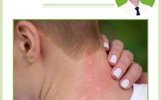  最近的蚊子怎么叮得这么痒(蚊子咬了会传染什么病)