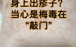  广东发现什么传染病了呢(广东流行的传染病)