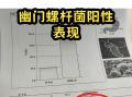  疫情后期症状(疫情后续)