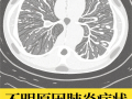  武汉新冠什么时候爆发的(武汉市新冠肺炎是从什么时候开始爆发的)