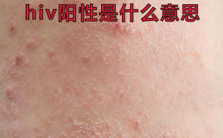  高危52阳性的症状(高危52阳性严重吗)