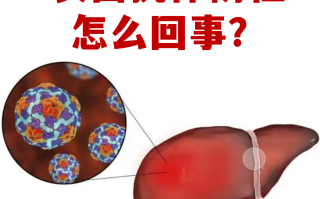 现在的病毒是什么情况(现在的病毒是什么情况引起的)