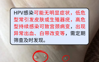  最近感染的病毒有什么症状与治疗(最近几天病毒感染情况)