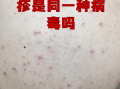  疫情的传染源是什么物质(武汉疫情传染源)
