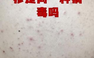  疫情的传染源是什么物质(武汉疫情传染源)