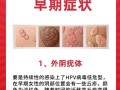  hpv哪种病毒比较严重(hpv哪几种病毒最严重)