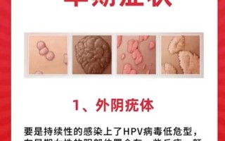  hpv哪种病毒比较严重(hpv哪几种病毒最严重)