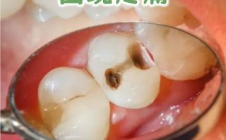 病毒对牙齿的危害有哪些(牙齿病毒病用什么药)