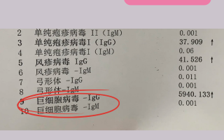 广东的病毒有多少(广东的病毒有多少种)