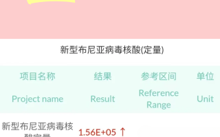  病毒用英语翻译(病毒英文翻译)