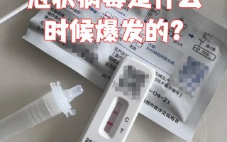  2020又有什么病毒了(2020今年的病毒叫什么名字)