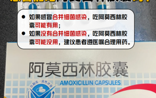 细菌性感冒吃什么药效果好(细菌性感冒吃什么药效果好细菌性咳嗽可引起哪些)