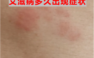  最近病毒感染有什么症状(最近病毒感染有什么症状表现吗)