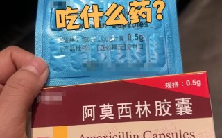  嗓子病毒性发炎是什么引起的症状吃什么药(嗓子发炎吃什么药最快)
