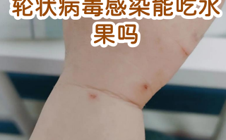  病毒感染不能吃什么食物(病毒感染不能吃什么水果)