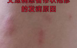  请问现在什么病毒最严重了呢(现在的病毒哪里最严重)