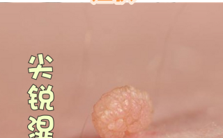  近几年出现的病毒有哪些症状(近期出现的病毒有什么症状表现)