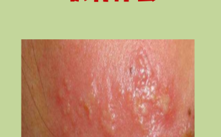  最近病毒有什么症状吗会传染吗(最近出现的病毒是什么病毒)