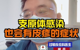  支原体的症状有哪些症状(支原体的症状是什么样)
