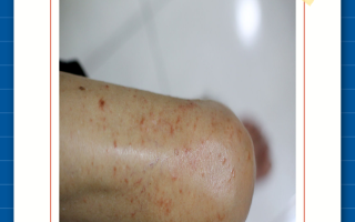  现在什么病毒感染(现在什么病毒感染,要打好证明才能上学)