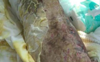  疫情留下的后遗症有多可怕图片大全视频(疫情留下的后遗症有多可怕图片大全视频讲解)